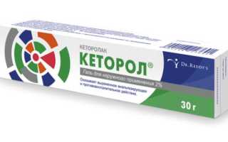 S70—S79 Травмы области тазобедренного сустава и бедра