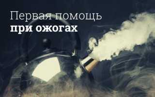 Ожог: виды, первая помощь, степени, возможные последствия