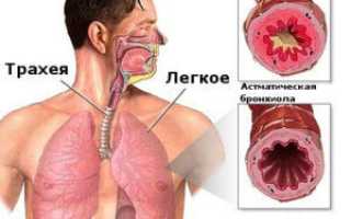 Как выглядят тараканы паразиты