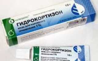 Гидрокортизон при молочнице отзывы