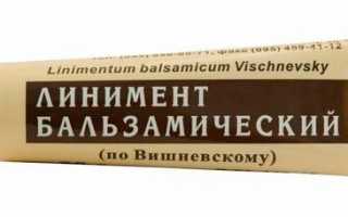 Мазь от гематом: какую лучше выбрать?