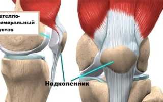 Швы Ямамото при вывихе надколенника