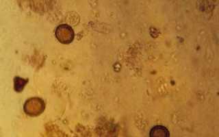 Не допускается наличие гельминтов echinococcus