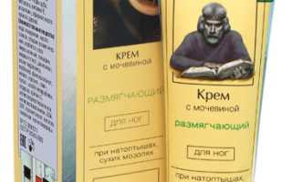 Мозоли: как быстро избавиться?