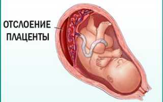 Диета при кишечной палочке у беременных