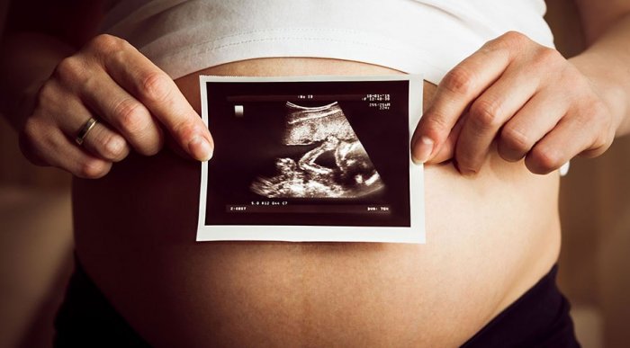 Развитие плода