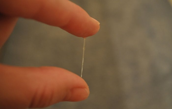 Цервикальная слизь