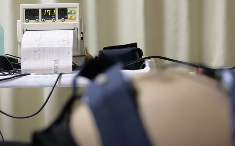 Кардиотокография (КТГ)