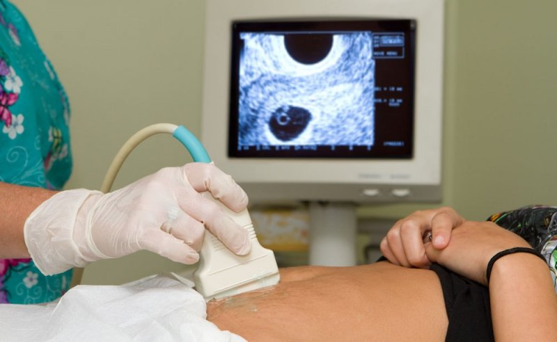 УЗИ при беременности