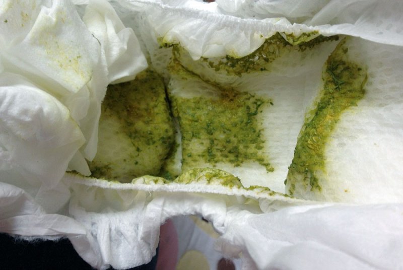 Зеленый жидкий стул