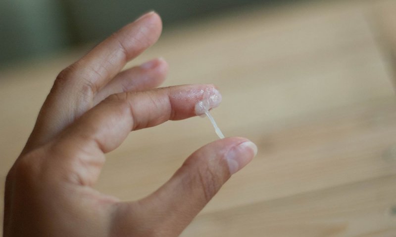 Белые выделения