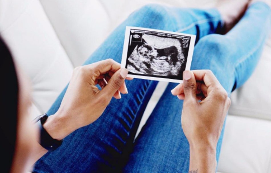 УЗИ ребенка