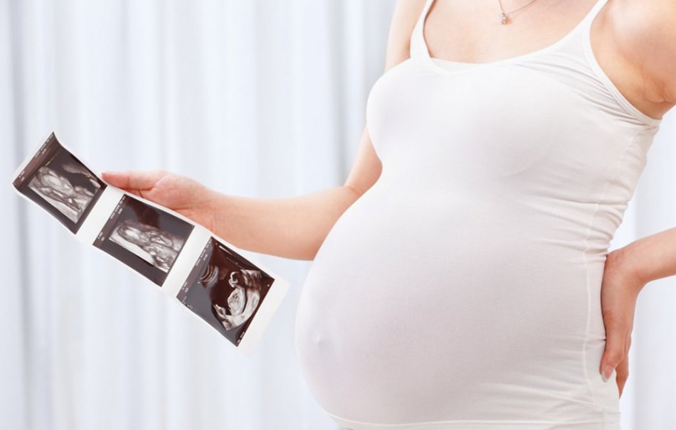 УЗИ плода