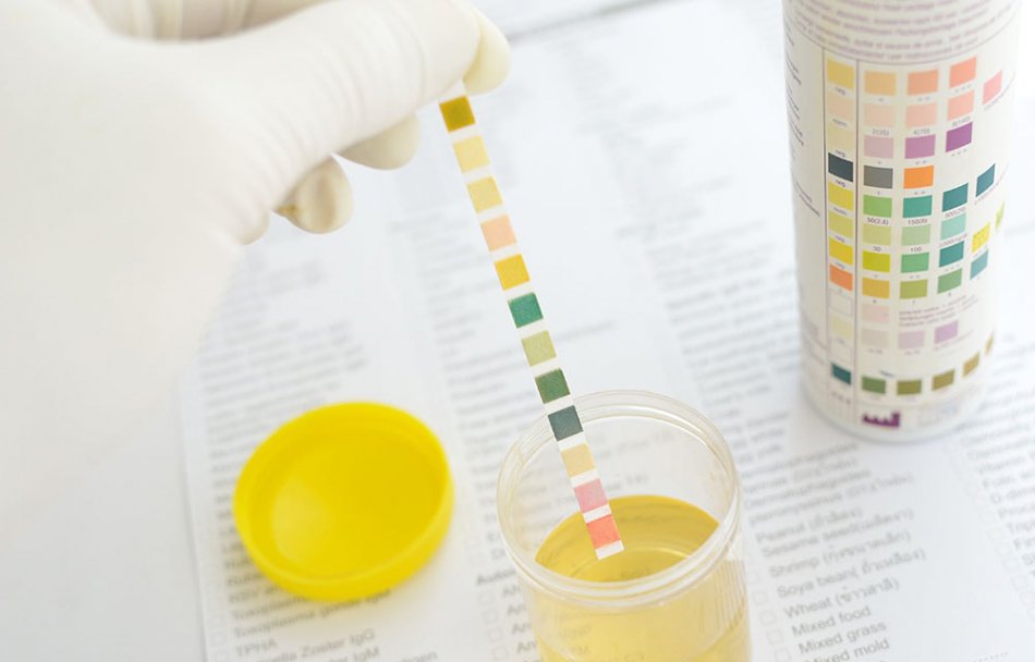 Анализ мочи