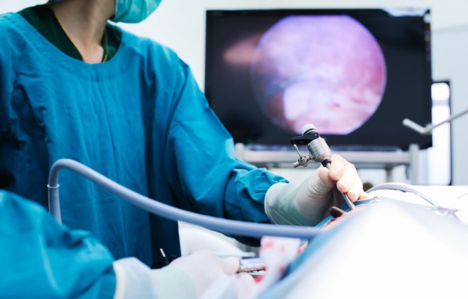 Лапароскопия