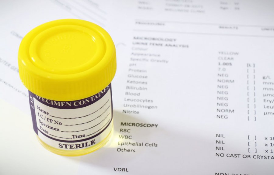 Анализ мочи