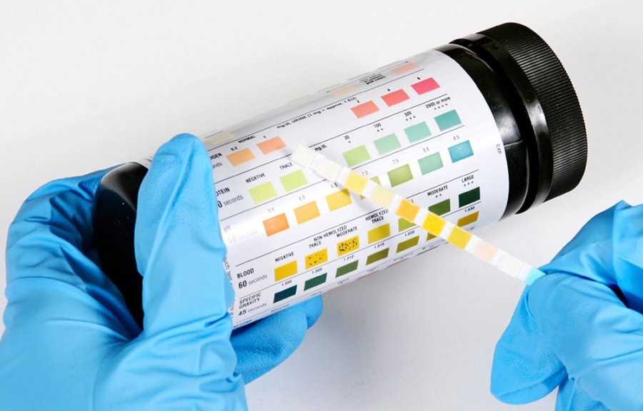 Анализ мочи