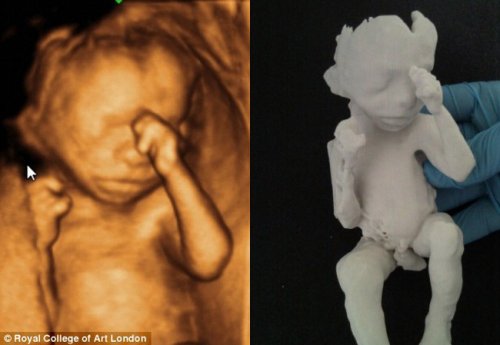 18 недель беременности