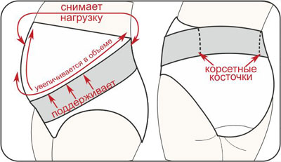 Дородовый пояс с ребрами жесткости Функции дородового пояса