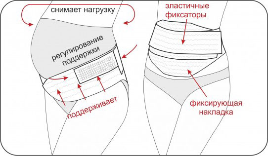 Конструкция и функции универсального бандажа Универсальный бандаж на липучках
