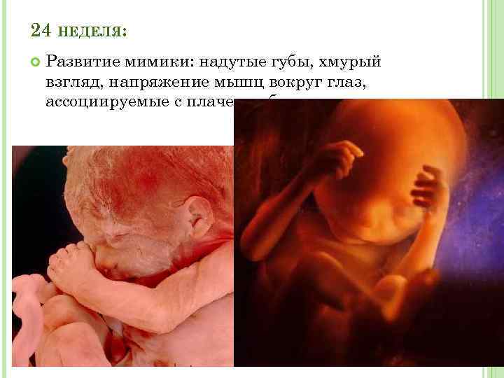 Ребенок 24 недели