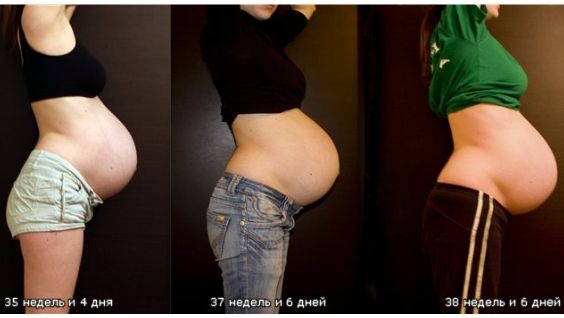 вторые роды раньше или позже первых