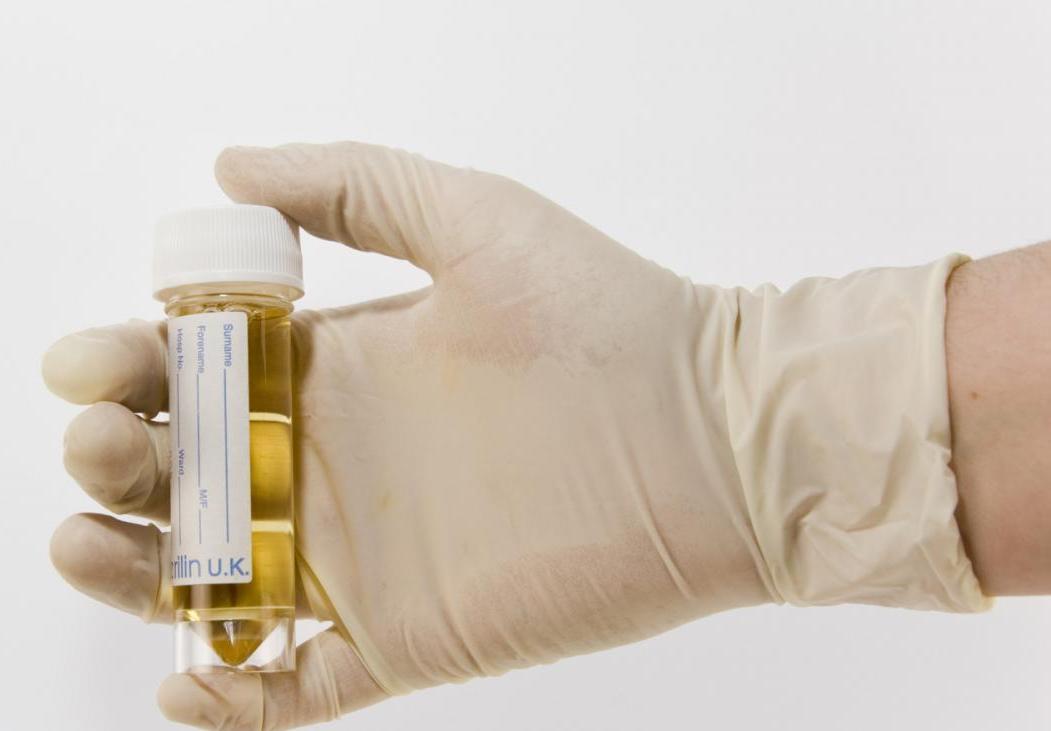 Бактерии в моче