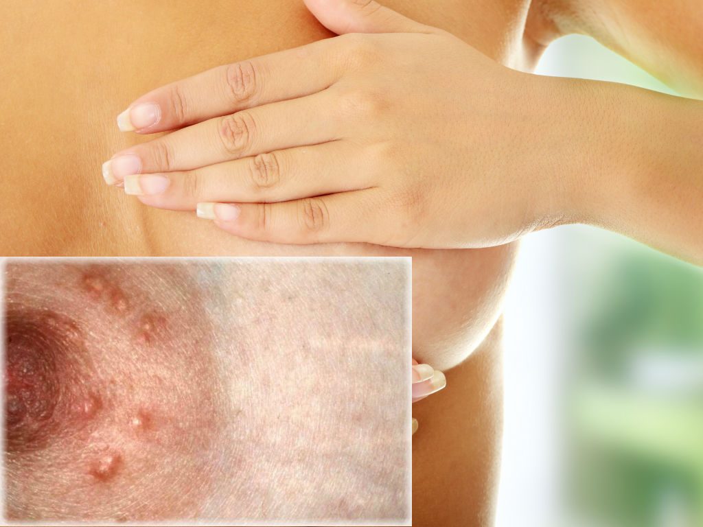 Грудь на ранних сроках