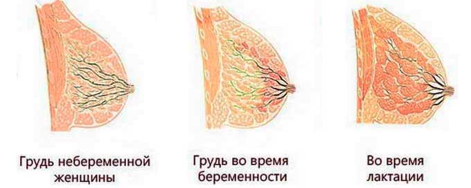 Как выглядит грудь при беременности