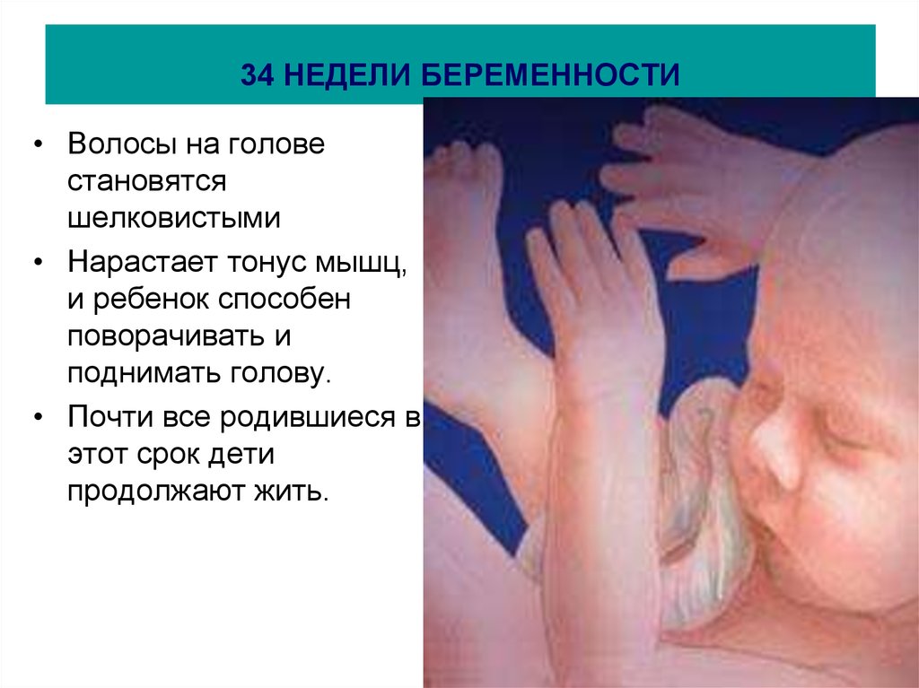 Ребенок на 34 неделе