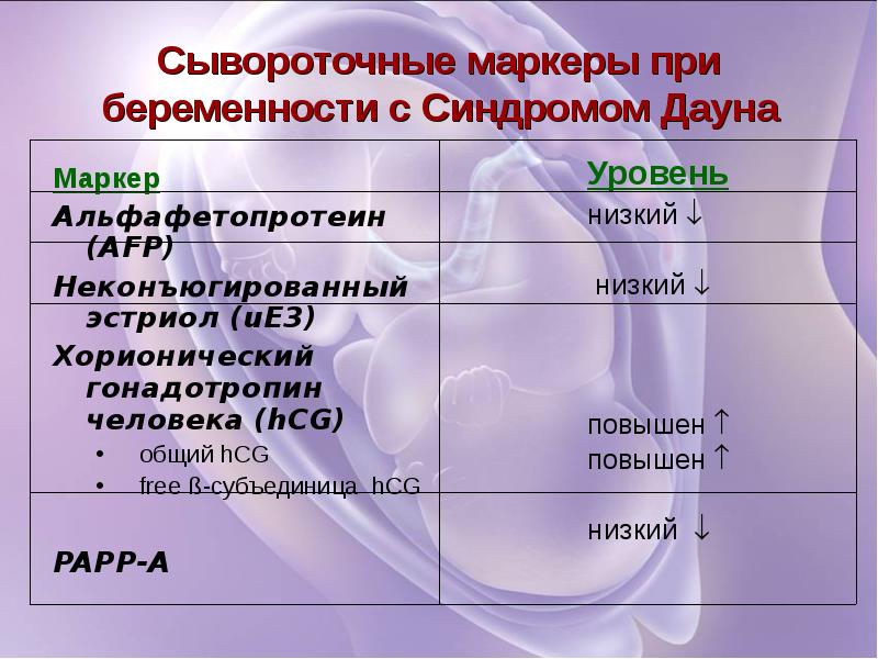 Маркер при синдроме дауна