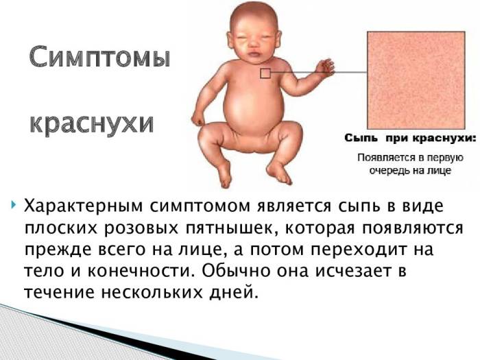 Симптомы краснухи у ребенка