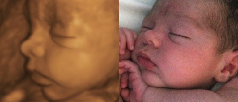 Ребенок на 32 неделе