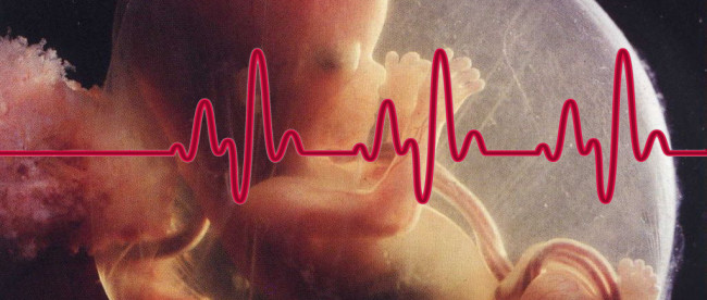 Шкала Фишера