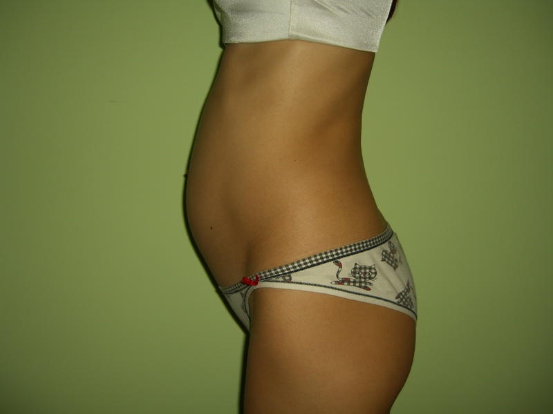 Живот на 17 неделе