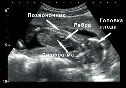 Фото УЗИ на 16 неделе беременности