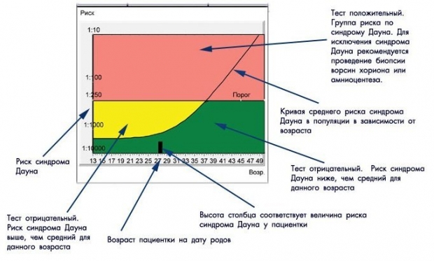 Как понять результаты пренатального скрининга