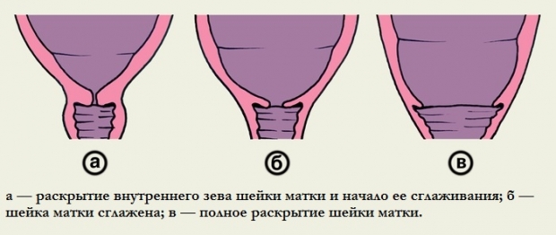 как понять, что роды близко