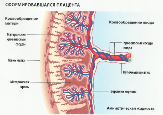 Преждевременная отслойка нормально расположенной плаценты