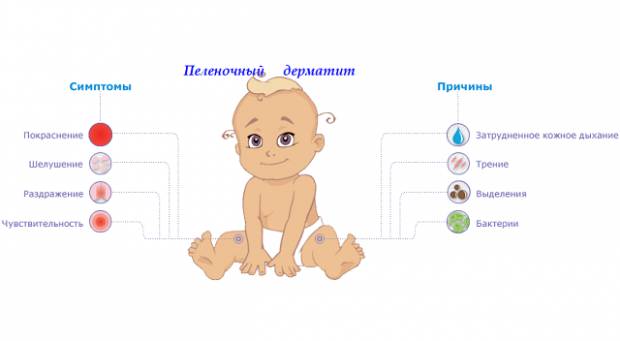 Опрелости у новорожденных детей