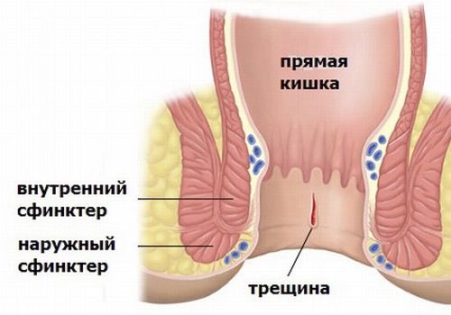 Картинка 5